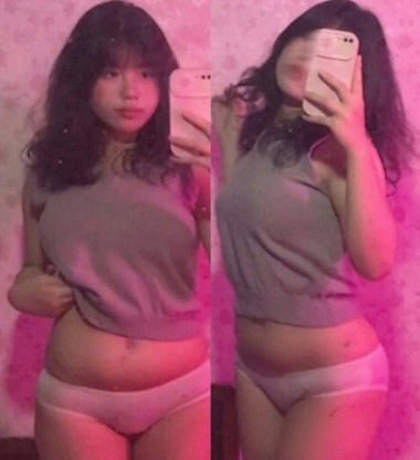 Em bé mập ú bướm hơi thâm